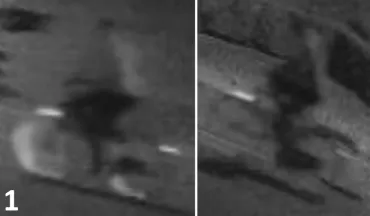 Drievoudige moord in Kessel-Lo